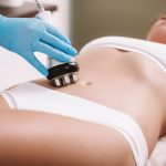 Radio Frequency treatment on Belly fat Radio Frequency treatment on Belly fat Clifton New Jersey Phenix Salon Suite, Strand Salon Suites, Suites by JC, Sola Salon Suites